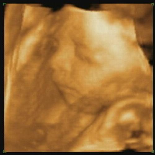 baby.jpg